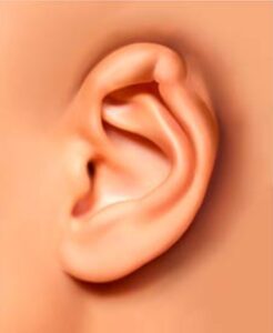 گوش پیچ خورده (Lop Ear)